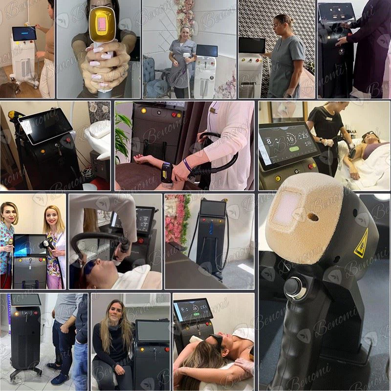 4 Wavelength 3000W Diode Laser Hair Removal Machine – Permanent, Painless, And Professional Solution factory