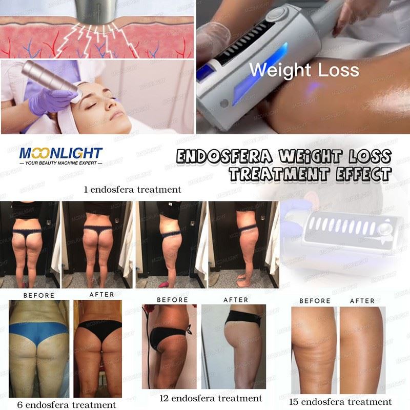 Inner Roller Ball Body & Face Sculptor factory