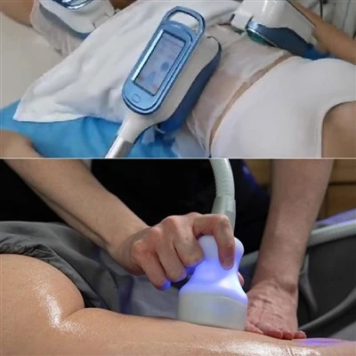 Coolsculpting   Peiriant   Cost