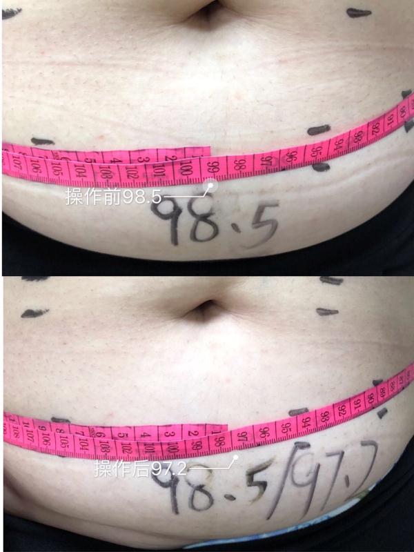 before and after 3 before and after 3