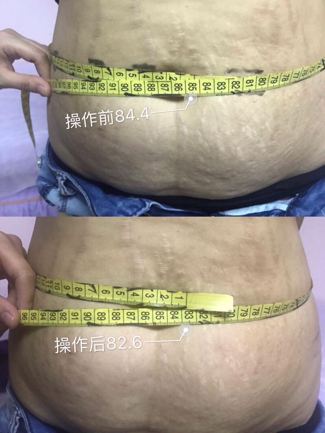 before and after 6 before and after 6