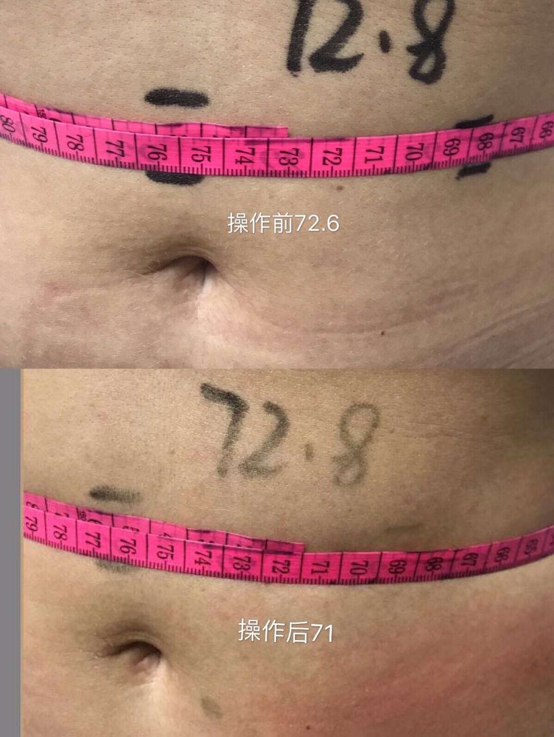before and after 5 before and after 5